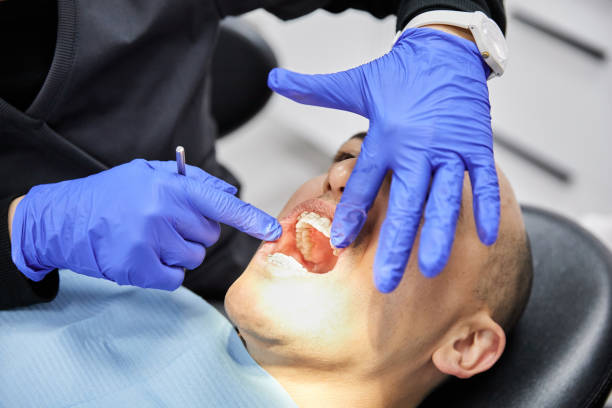 Best Knocked-Out Tooth Emergency  in Struthers, OH